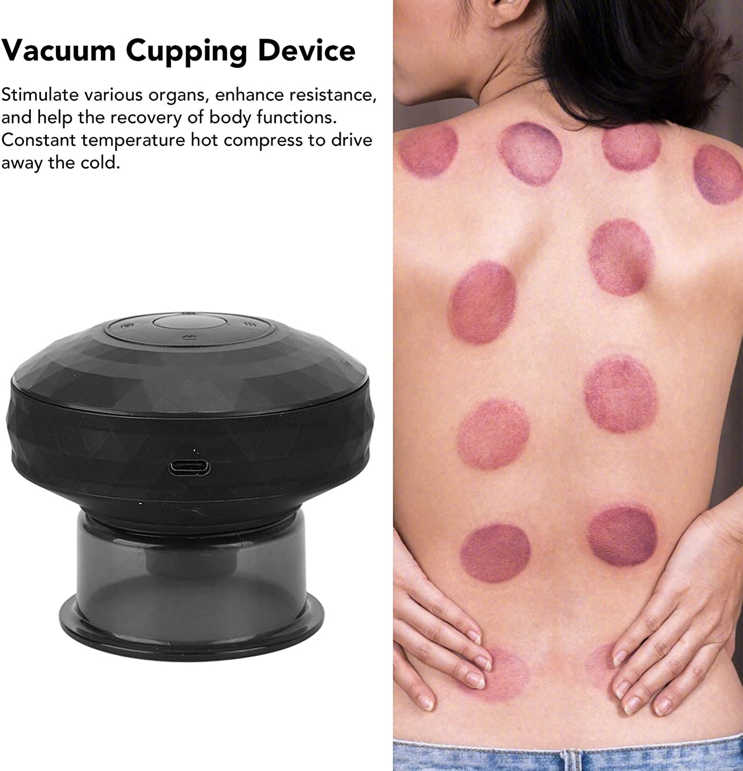 ألة الحجامة الكهربائية للجسم - Ventouse Hijama électrique