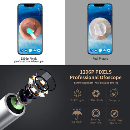 Kit de nettoyage des oreilles intelligents sans fil avec caméra et lumière LED NE3