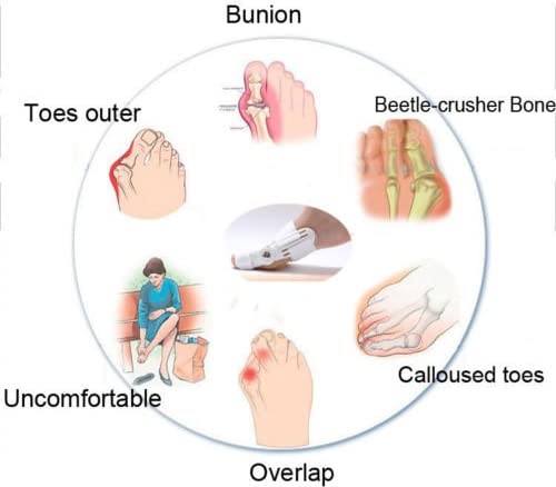 Correcteur Et Ort-hèse De Pied – Blanc