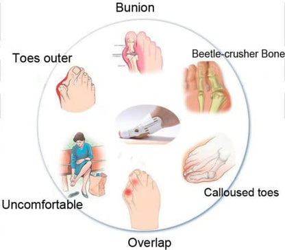 Correcteur Et Ort-hèse De Pied – Blanc