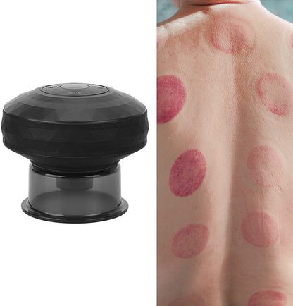 ألة الحجامة الكهربائية للجسم - Ventouse Hijama électrique