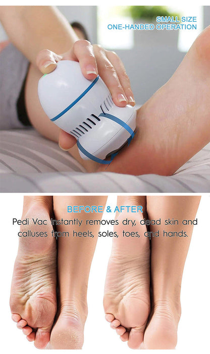 Râpe à Pied et Mains anti-Callosités avec Aspirateur Intégré