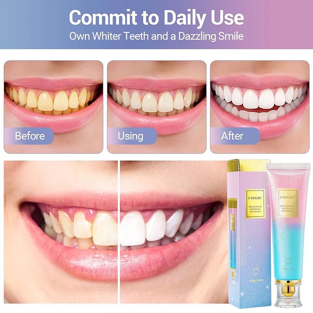 Dentifrice blanchissant à la niacinamide UTOGRU Triple action blanchissante – معجون تبييض الأسنان