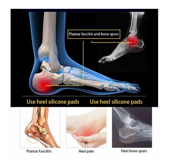 Paire de talon en silicone souple, soulage la douleur au talon, زوج وسادات للكعب الناعمة من السيليكون، تخفف من آلام الكعب